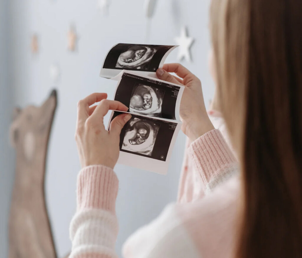 A woman gently holds and looks at ultrasound images in a softly decorated nursery, symbolizing anticipation, maternal connection, and the emotional journey of pregnancy.